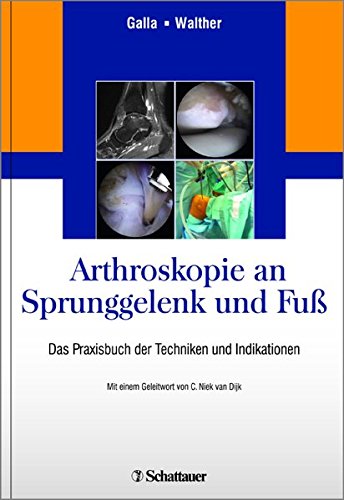 http://www.schattauer.de/de/book/detail/product/1150-arthroskopie-an-sprunggelenk-und-fuss.html